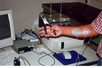 Diagrama de conducción nerviosa motora