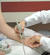 Representación de estimulación nerviosa en EMG